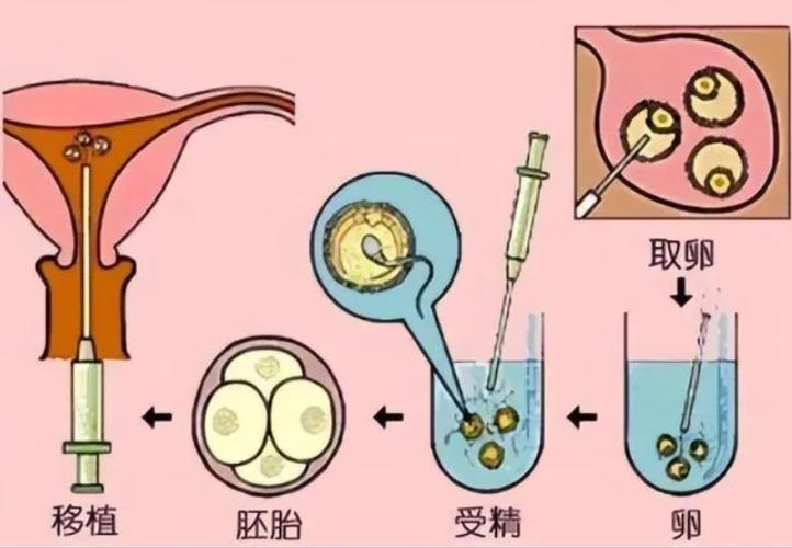 广州试管供卵婴儿_广州试管供卵婴儿：新生命的奇迹